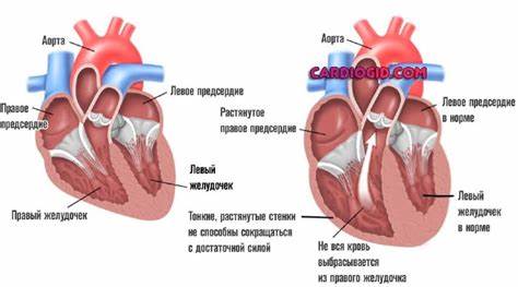 Сердечная недостаточность на диете Сердечная недостаточность - признаки, симптомы, лечение и первая помощь Сердечная недостаточность - признаки, симптомы, лечение и первая помощь Сердечная недостаточность на диете