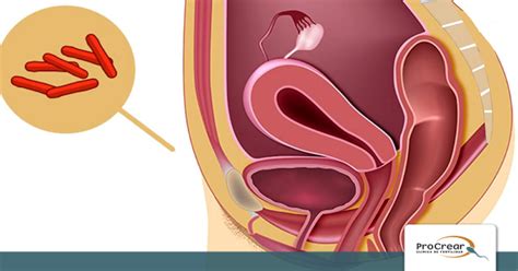 Significado de procrear en en español clínica de fertilidad archivos - Procrear