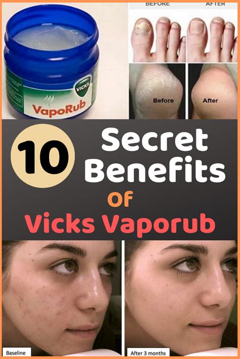 10 Secret Benefits Of Vicks Vaporub | Vicks vaporub, Vicks, Uses for vicks