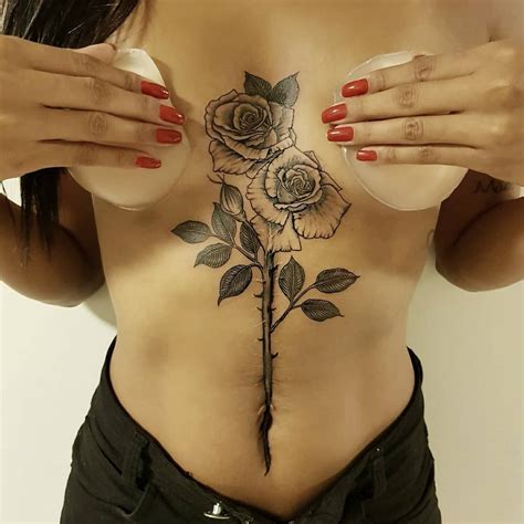 Wann ist ein dammschnitt verheilt? MyTattoo.com | Cover-up-Tattoos: Wenn aus Narben ...