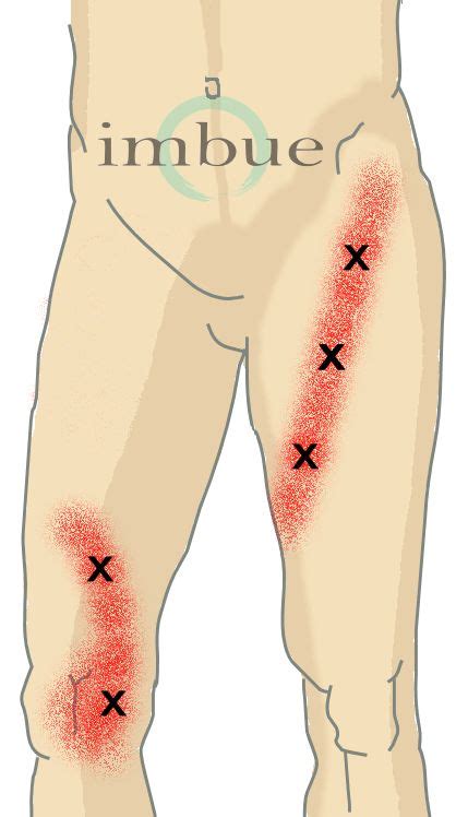A portion of the body excluding the limbs, neck, and head. Best 81 Body Moves - To the Point images on Pinterest | Health and fitness | Knee pain, Quad ...
