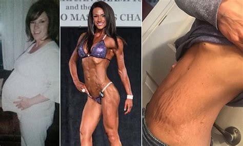 Scratching can cause the marks to break open and. Bodybuilder Nicole Engman with two kids proudly shows off ...