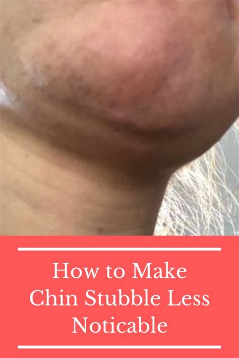 Infected ingrown hairs can be painful. How to Hide Stubble with Makeup (With images) | Unwanted ...