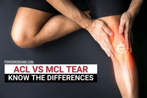 If you have also suffered acl damage, recovery could take significantly longer. ACL vs MCL Tear: Know the Differences in 2020 | Ligament injury, Knee injury, Knee ligaments