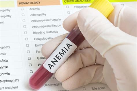 Anemia Perniciosa 【Causas, Síntomas y Tratamiento】