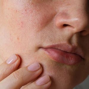 Moms are raving about this anti aging cream! Uneven Skin Texture Skincare Products | Natural Beauty Spa