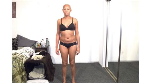 If the breast cancer comes back in the same breast it's called local recurrence. Breast Cancer Time lapse - YouTube
