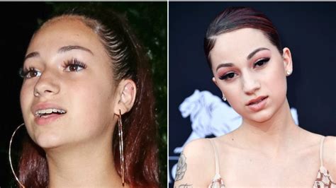 If she was unsure about. Bhad Bhabie Shows Off Her New $40,000 Porcelain Veneers on ...