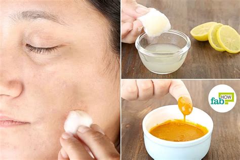 Colour of your skin may play a vital role in the duration and intensity of hyperpigmentation treatment. How to Get Rid of Hyperpigmentation: Top 10 Remedies to ...