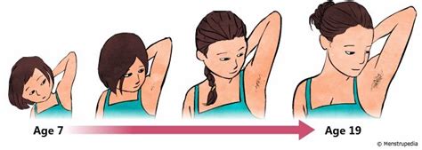 Terminal hair, which replaces vellus hair, has the following characteristics. Physical changes in girls during puberty | puberty ...