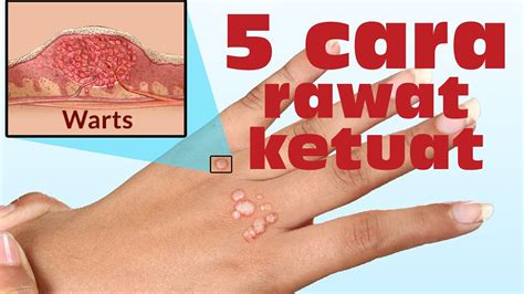 Drnoordindarus get more of dr. KETUAT! 5 cara terbaik dan natural untuk merawat nya — Dr ...