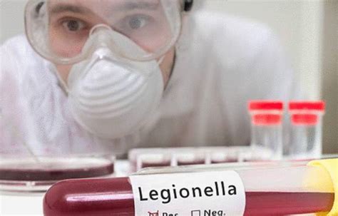 Jul 02, 2009 · le pneumocoque est l'agent infectieux le plus fréquent et fait parti des deux germes les plus graves avec legionnella pneumophila (responsable de légionellose). Qu'est-ce que la légionellose - Tout pratique