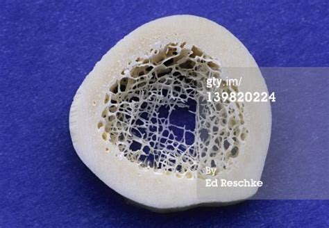 Cross section of a human bone. Senior Thesis Research Blog: Bone Cross-Section | Bones ...