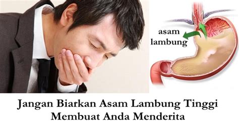 Maybe you would like to learn more about one of these? Obat Herbal Untuk Menurunkan Asam Lambung Tinggi ~ Sehat ...