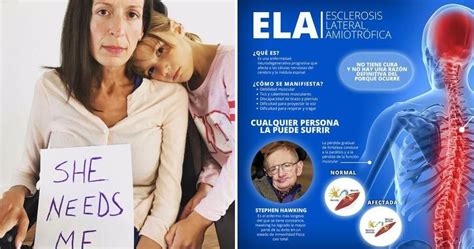 La esclerosis lateral amiotrófica, abreviada como ela, es una enfermedad progresiva del sistema nervioso que destruye las células nerviosas y atrofia la capacidad motora. Esclerosis lateral amiotrófica o enfermedad de Lou Gehrig ...