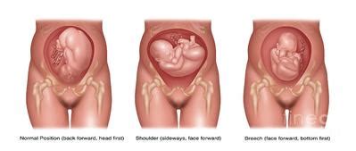 Usia kehamilan 12 minggu (kandungan 3~4 bulan) perkembangan janin dan kondisi bumil. Bentuk Janin Usia 3 Bulan Dalam Kandungan - Berbagi Bentuk ...