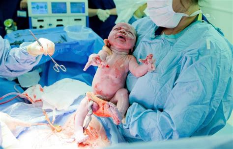 Bayi kurang berisiko mendapat masalah pernafasan. 5 Risiko Ibu Bersalin Caesarean Yang Perlu Suami Tahu ...