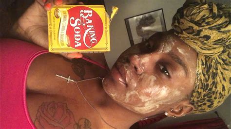 Powerful diy face mask that removes blackheads whiteheads clears skin tags diy blackhead remover diy. DIY Baking Soda and Honey Face Mask - YouTube