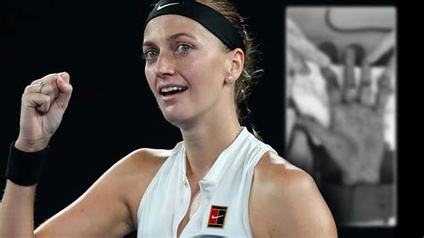 Petra kvitova says she is 'living the dream' as she competes in the french open this week over a year on from making her return after a knife attack. Australian Open 2019: Petra Kvitova comeback from stabbing ...