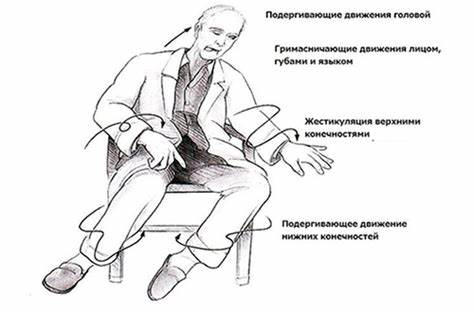 Ревматическая хорея диета Болезнь Хантингтона (хорея Гентингтона): что это такое, симптомы и Болезнь Хантингтона (хорея Гентингтона): что это такое, симптомы и Ревматическая хорея диета