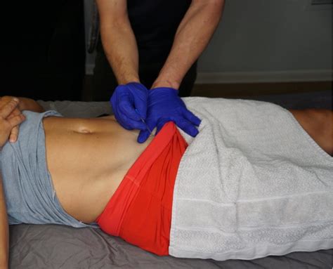 Advanced sexual techniques video reviewed by 7 users, added by 42 users, included to 12 collections. Pelvic Pain Course Landing Page | Integrative Dry Needling ...