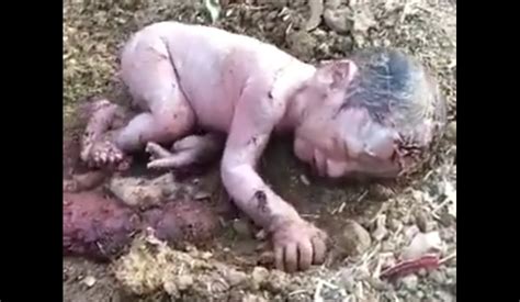 Laws and procedures for adopting a newborn baby differ in every country, though the laws for international adoption are more structured. Newborn Baby Was Abandoned in a Garbage Dump, Family ...