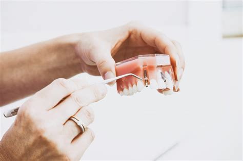 Selain gigi geraham bungsu, pencabutan gigi juga bisa dilakukan karena adanya infeksi atau penyakit gusi, kemudian gangguan pada rahang, hingga saat hendak mencabut gigi ke dokter gigi, anda wajib berada dalam kondisi prima. Menelisik Fakta Pencabutan Gigi Bagian Atas - RS Al-Irsyad ...