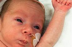 preemie premature healthychildren developmental