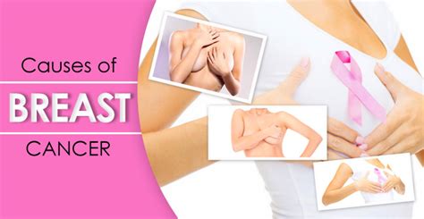 These are symptoms that can often indicate the presence of cancerous cells in the breast. Causes of Breast Cancer and the Major Risk Factors