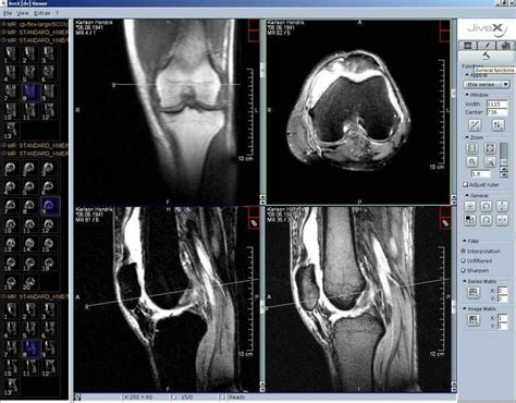 Anyone in the field of medicine knows the importance. JiveX: Free DICOM Viewer for Windows