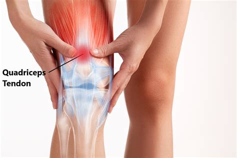 Think of the front leg as the 'working leg' and the back leg as the 'supporting' leg. Front Leg Musclevtendon : Achilles Tendon Pain Causes ...