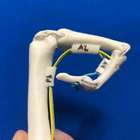 Tibialis posterior, flexor digitorum and flexor hallucis longus tendons: 3D Printable Finger Flexor Tendon Anatomy Model (Left Index) by Robin Janson