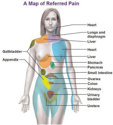 Examples of organ systems include the circulatory system and the digestive system. Map of Referred Pain in Woman Body Pinned by www.Trinity-Wellness-Solutions.com | Referred pain ...