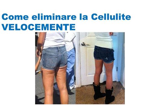 Fai esercizi con gli elastici o con i pesi per far lavorare i muscoli dell'esterno coscia e tonificarli. How to get rid of cellulite naturally on thighs; Come ...