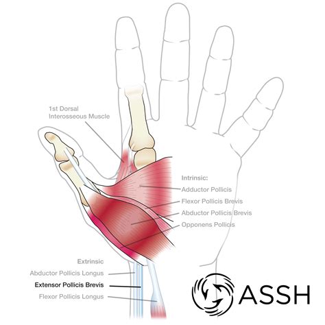 When muscles contract, they pull on the tendons to move the bones. Body Anatomy: Upper Extremity Muscles | The Hand Society