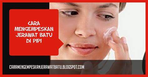 Jerawat di pipi juga bisa terjadi karena kurang maksimal membersihkan wajah. Bagaimana Cara Mengempeskan Jerawat Batu