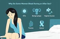 bleeding causes verywell seong joshua postcoital infections infection sexually