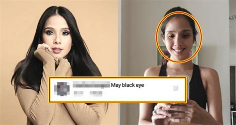 Ask anything you want to learn about maxene magalona by getting answers on askfm. Maxene Magalona 's "Black Eye" Sparked Speculations From Netizens
