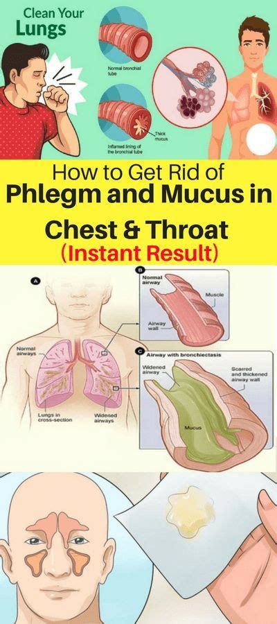 How to use an aspirator to remove mucus infant care. How To Get Rid Of Phlegm & Mucus In Chest & Throat ...