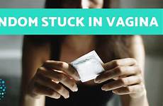 condom vagina stuck do