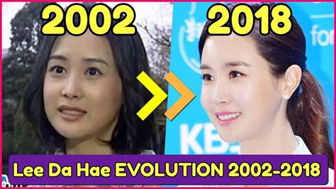 Lee da hae's before and after plastic surgery picture above explains her change. 5 Artis korea yang menjalani Operasi Plastik (Korea ...