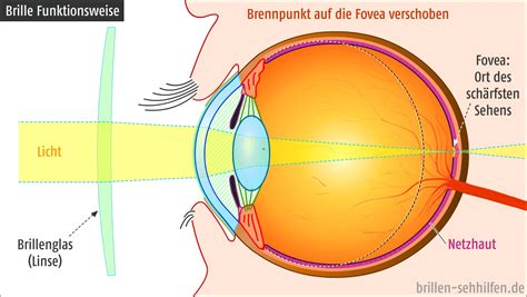 Der durchbruch der kontaktlinse begann mit der erfindung des hydrogels im. Wie funktioniert eine Brille?