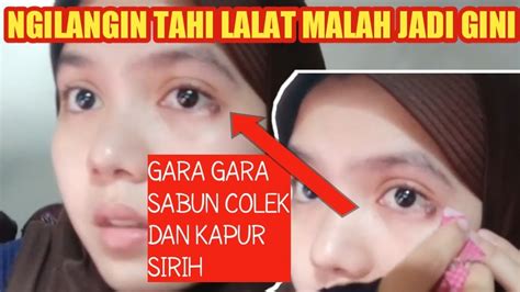 Akan tetapi, mereka memiliki sifat belas kasihan terhadap orang lain yang menderita, pandai bergaul, dan dapat menyimpan rahasia. CARA MENGHILANGKAN TAHI LALAT TANPA OPRASI BAHAYA NGAK SIH ...