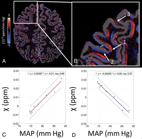 Scopri ricette, idee per la casa, consigli di stile e altre idee da provare. Printiable Mape Of Arteries And Viens - Eye veins, human ...