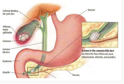 You do not need to search for a hospital independently, negotiate with the administration, establish communication with doctors, look for translators, and solve a number of organizational issues. Laparoscopic Gall Bladder Surgery in Jaipur | Dr Vipin Jain