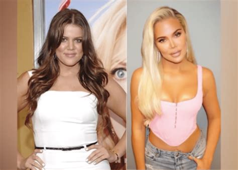 Plastic Surgeon Weighs In On Khloe Kardashian's Before And After Photos 