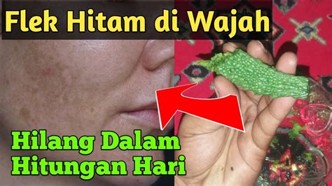 Berikut ini ulasan untuk menghilangkan flek hitam pada wajah. Cara Menghilangkan Flek hitam di Wajah - Macam Khasiat ...