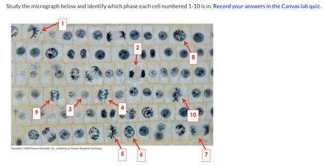 Mitosis in onion root tip cells. Onion Cell Mitosis Png & Free Onion Cell Mitosis.png Transparent Images #149489 - PNGio