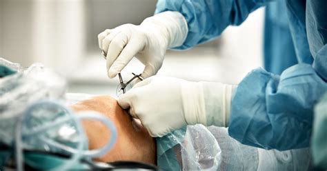 Breast cancer treatments that increase the risk of blood clots. How to Prevent Blood Clots After Surgery