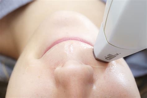 Our laser hair removal cost & pricing statistics report includes the average fees of dermatologists & laser technicians in medical spas and clinics. Frequently Asked Questions - LaserYou PicoSure Tattoo ...